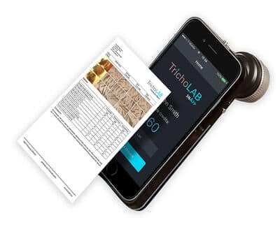 Tricholab Behandlung