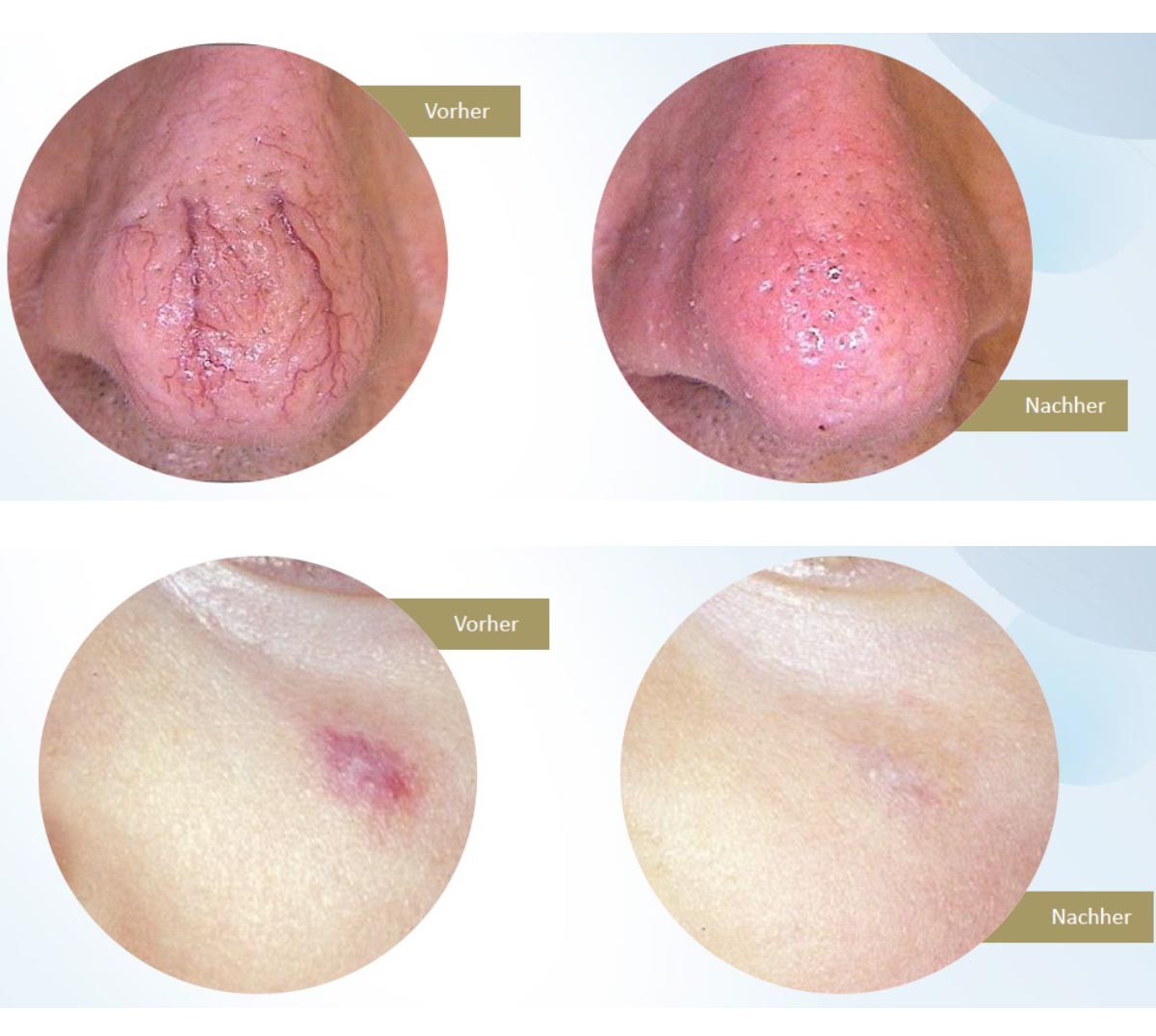 Hautarzt Frankfurt Lasermedizin