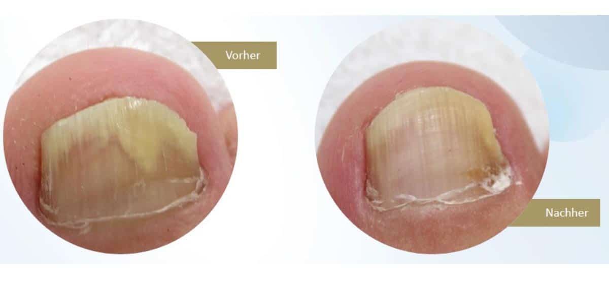 Hautarzt Frankfurt Lasermedizin